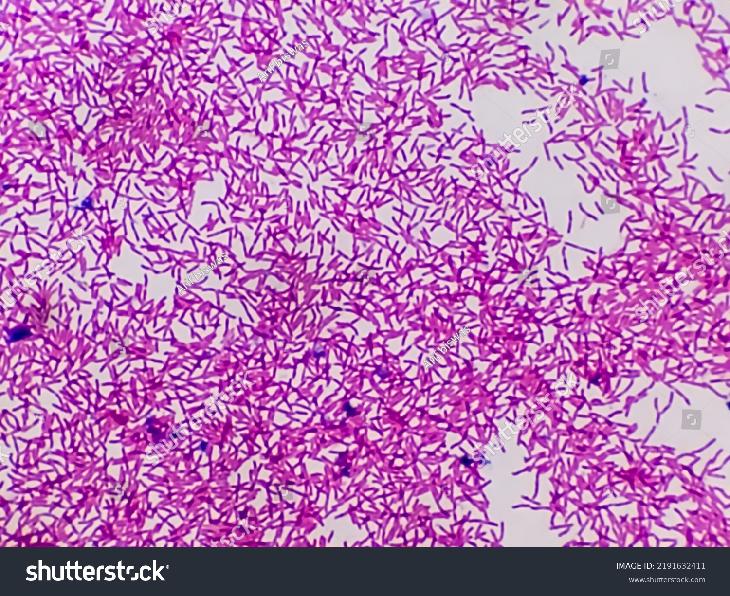 Microscopic View Gram Stain Showing Rod Stock Photo 2191632411 ...