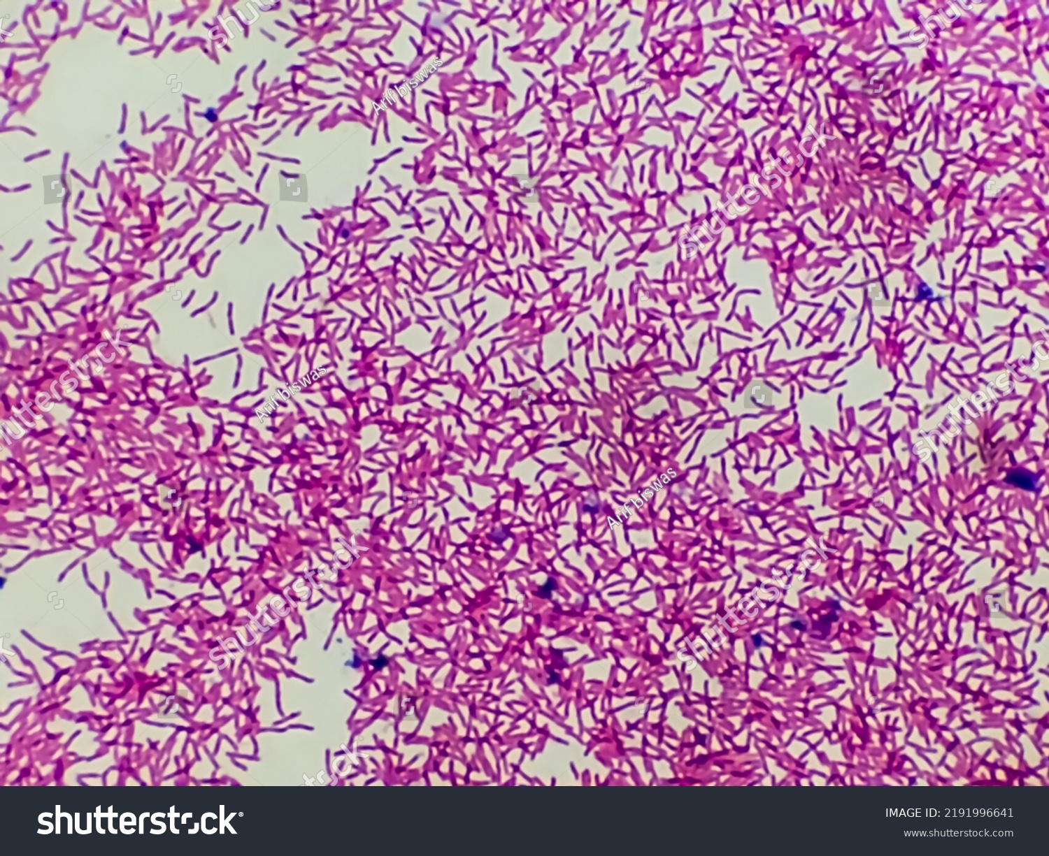 Microscopic View Gram Stain Showing Rod Stock Photo 2191996641 ...