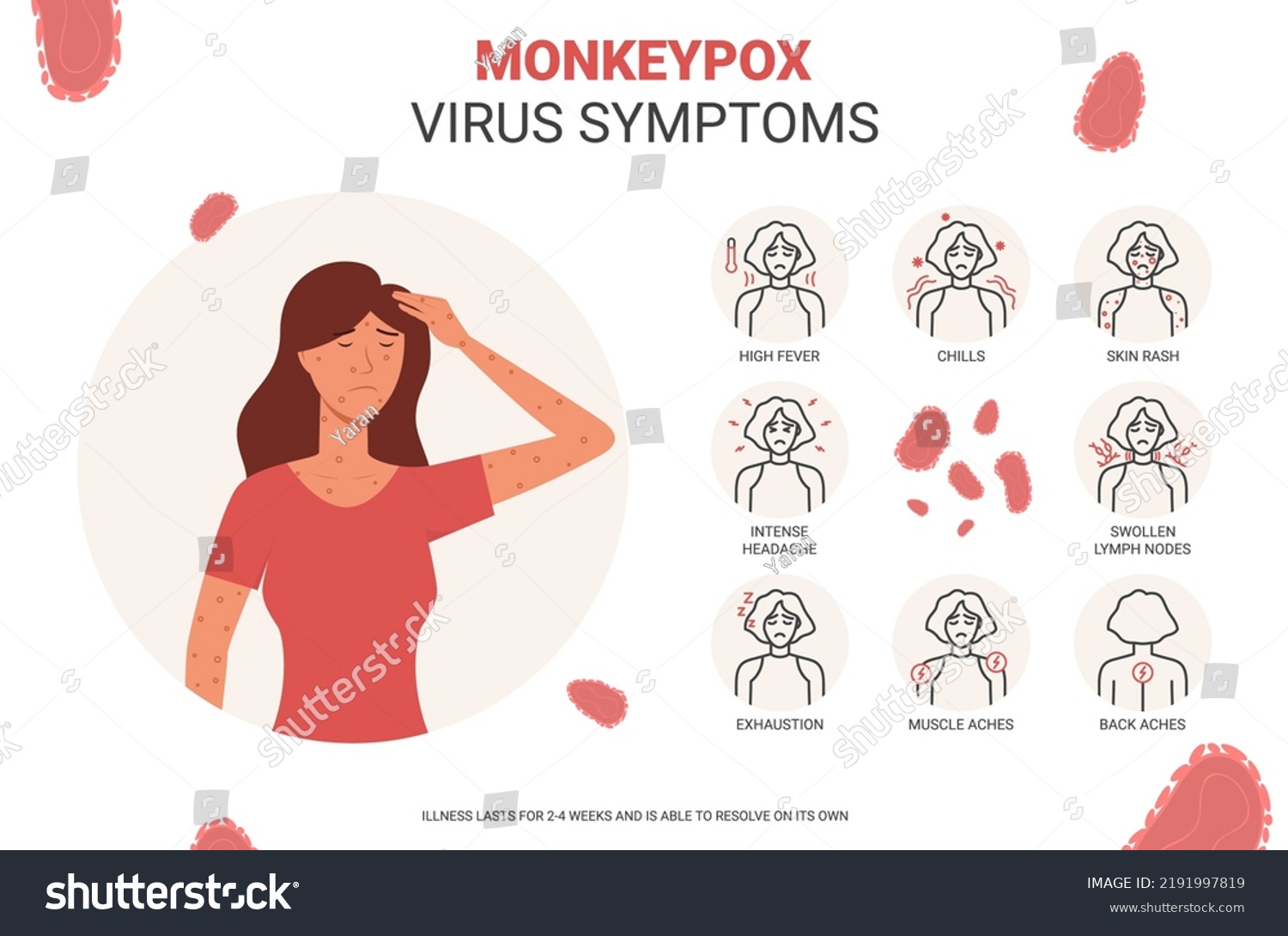 Banner Monkeypox Virus Symptoms Concept Monkeypox Stock Vector (royalty 