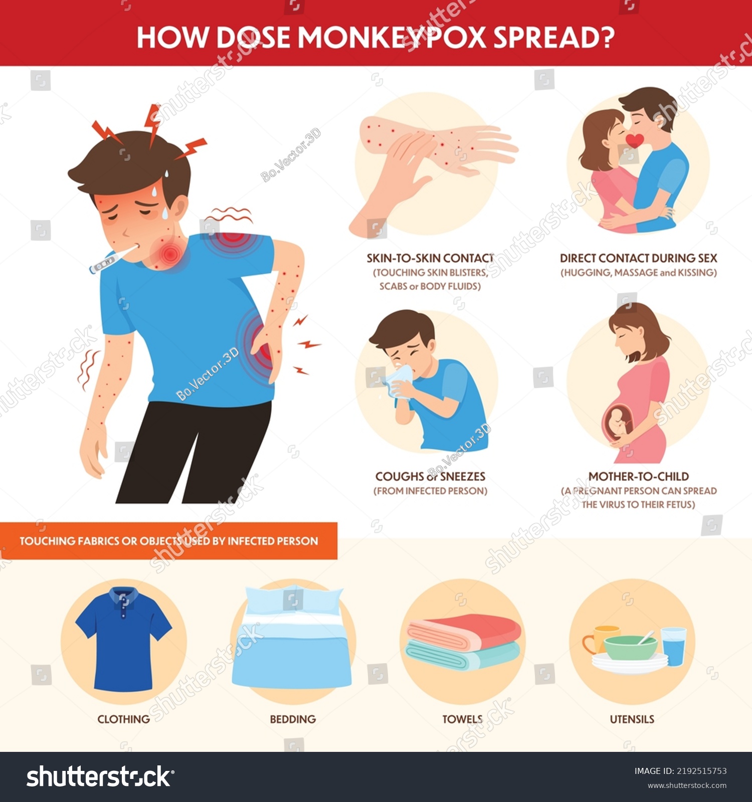 Infographics How Dose Monkeypox Outbreak Can Stock Vector (Royalty Free ...