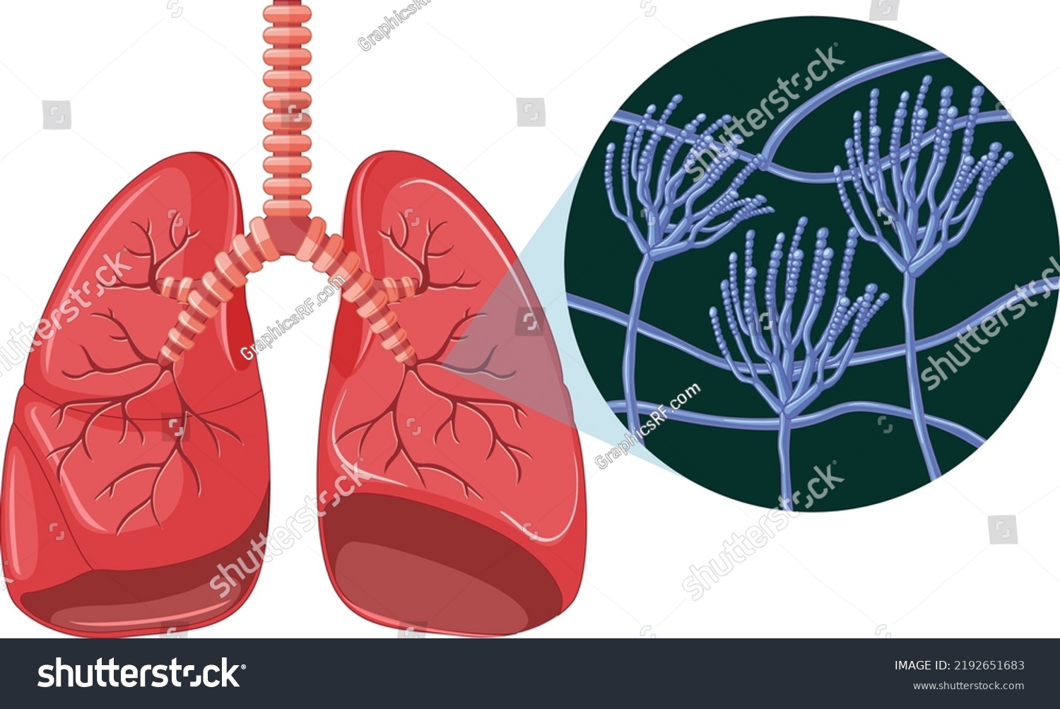 Mold Spores Grow Human Lungs Illustration Stock Vector (Royalty Free ...