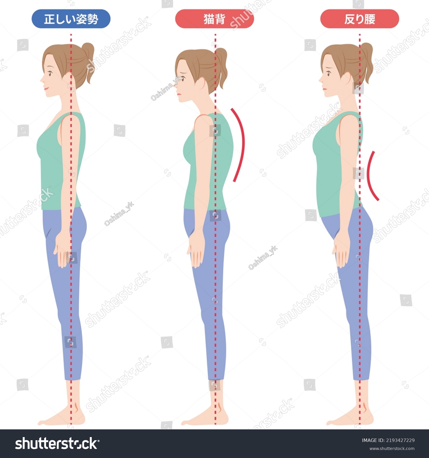 Woman Left Correct Posture Hunchbackwarped Waist Stock Illustration ...