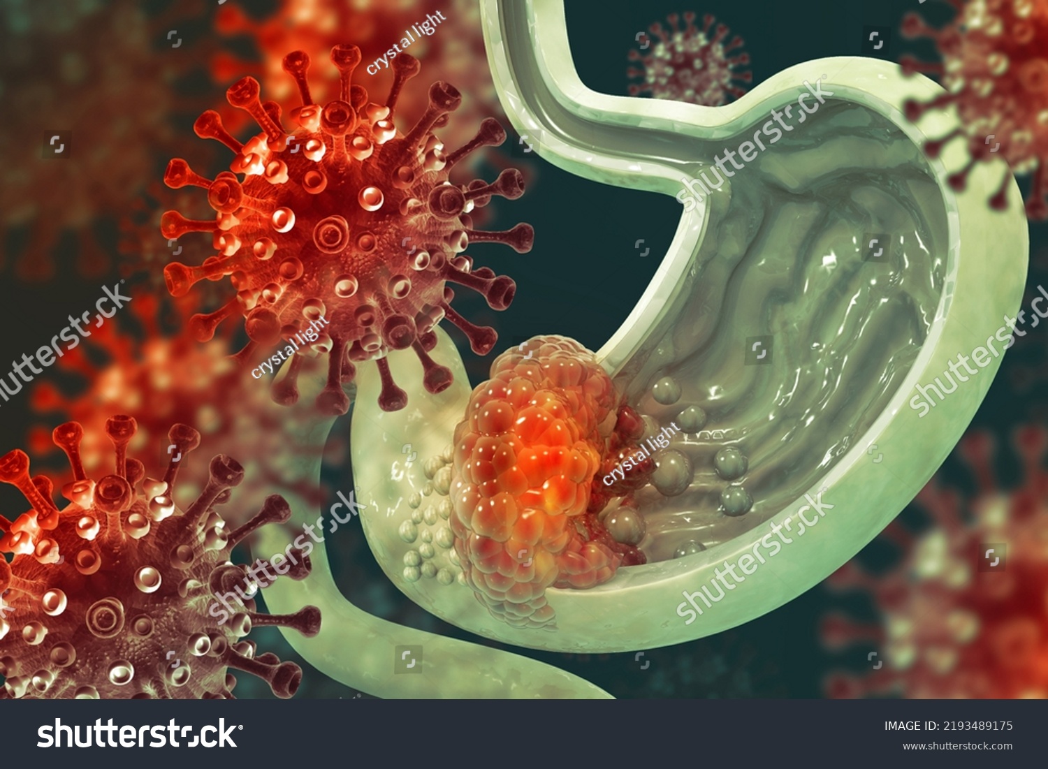 Cross Section Human Stomach Viruses Bacteria Stock Illustration