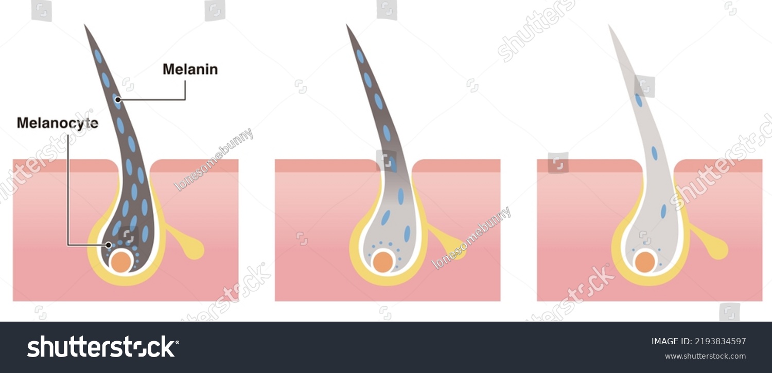 Cross Section Black Hair Turn Gray Stock Vector (royalty Free 