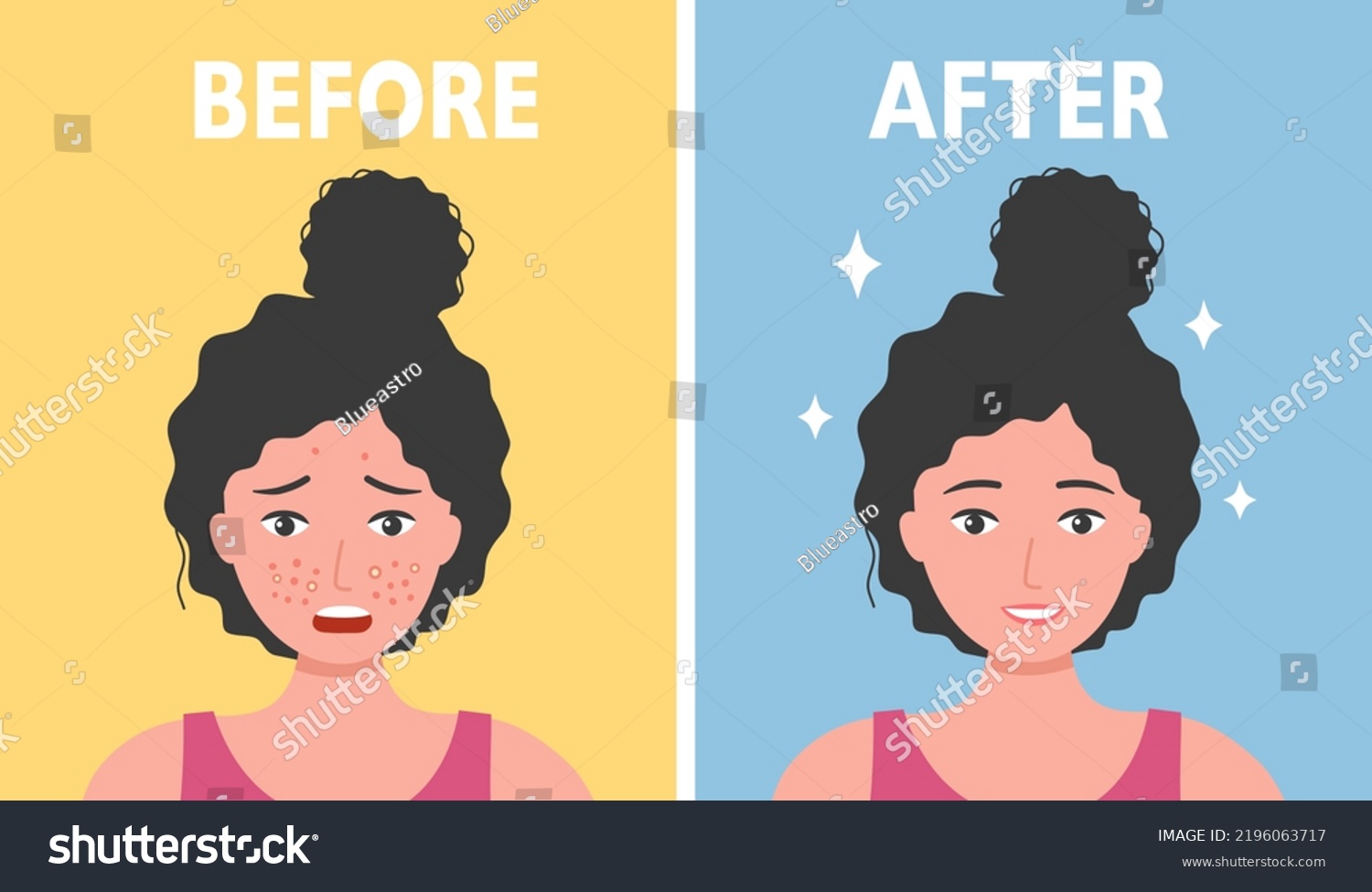 woman-face-acne-before-after-skin-stock-vector-royalty-free