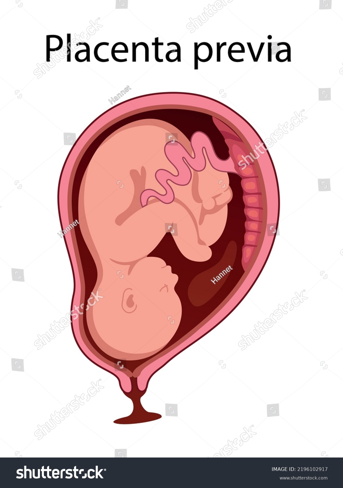 Placental Locations Fetus Uterus During Pregnancy Stock Vector Royalty Free 2196102917 