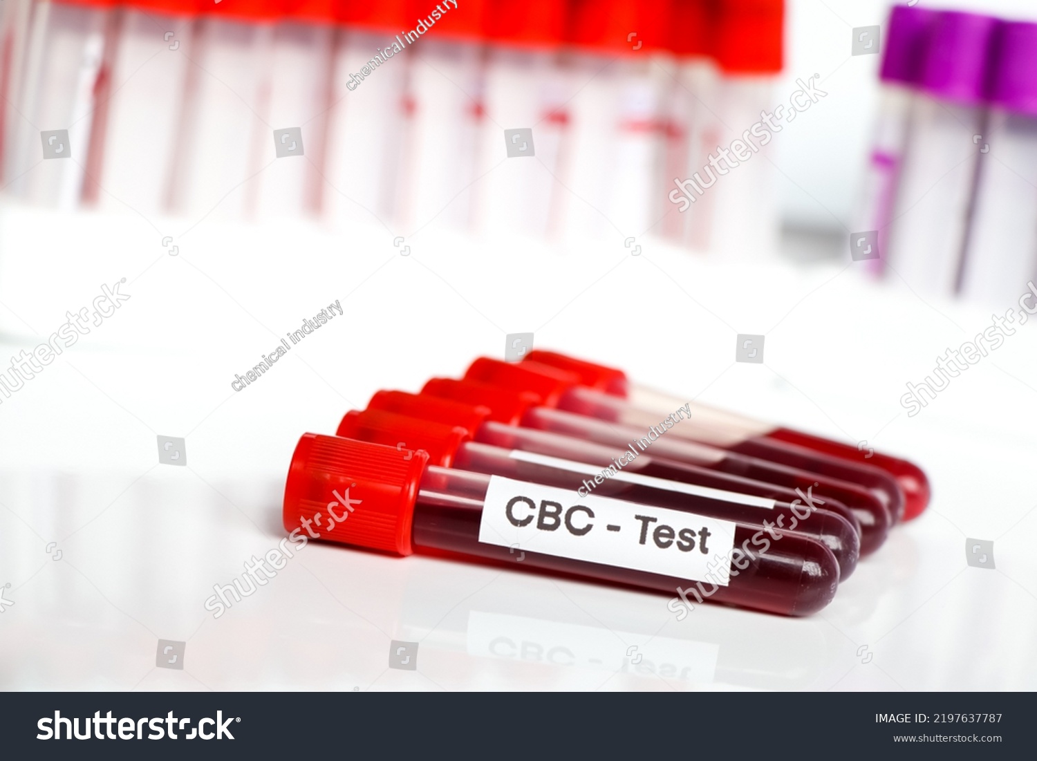 Cbc Test Abnormalities Red Blood Cells Stock Photo 2197637787 ...