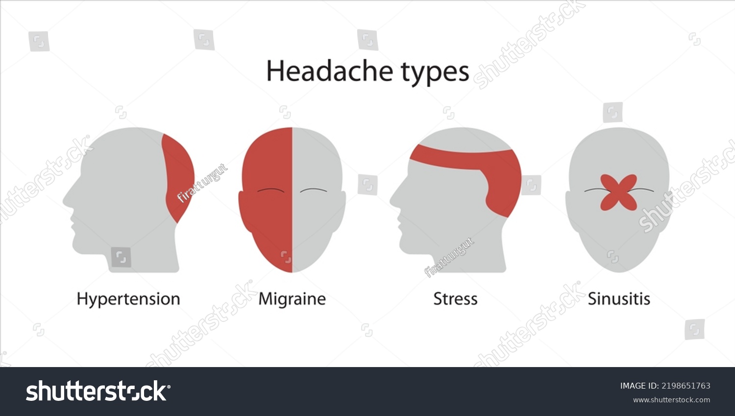 Headache Types Hypertension Migraine Stress Sinusitis Stock Vector ...