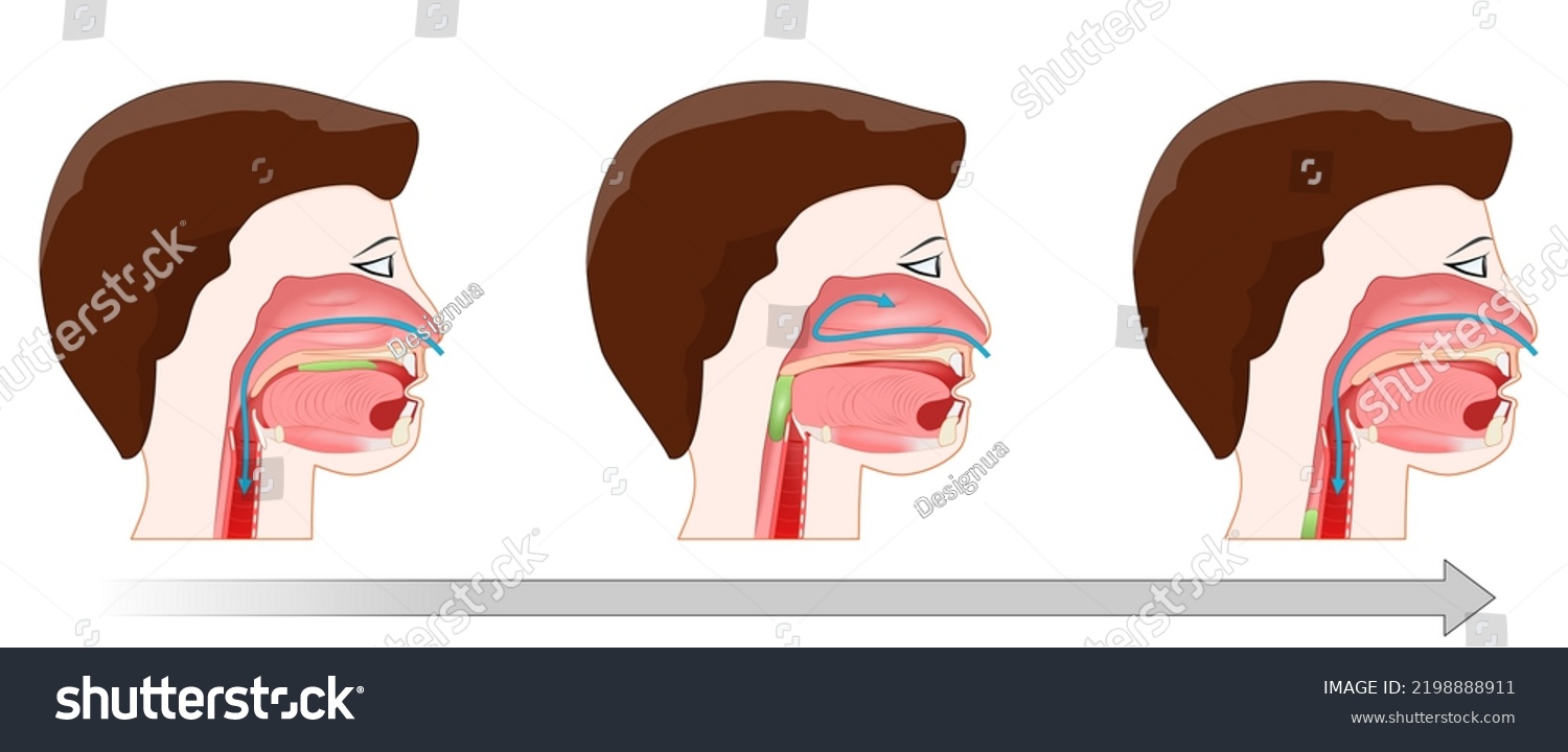 Swallowing Process Deglutition After Form Bolus Stock Vector (Royalty ...