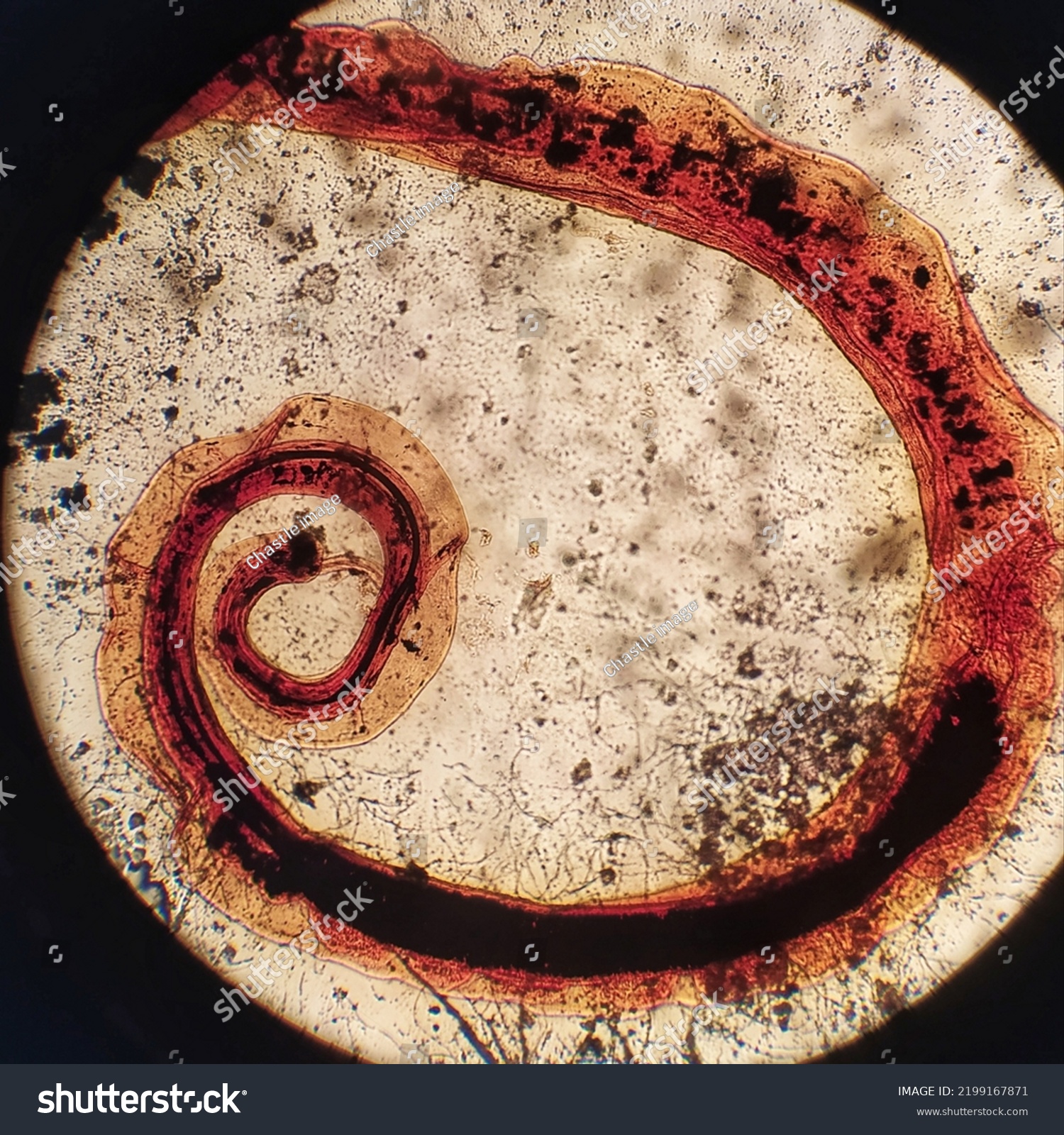 Trichuris trichiura bajo el microscopio parásito Foto de stock Shutterstock