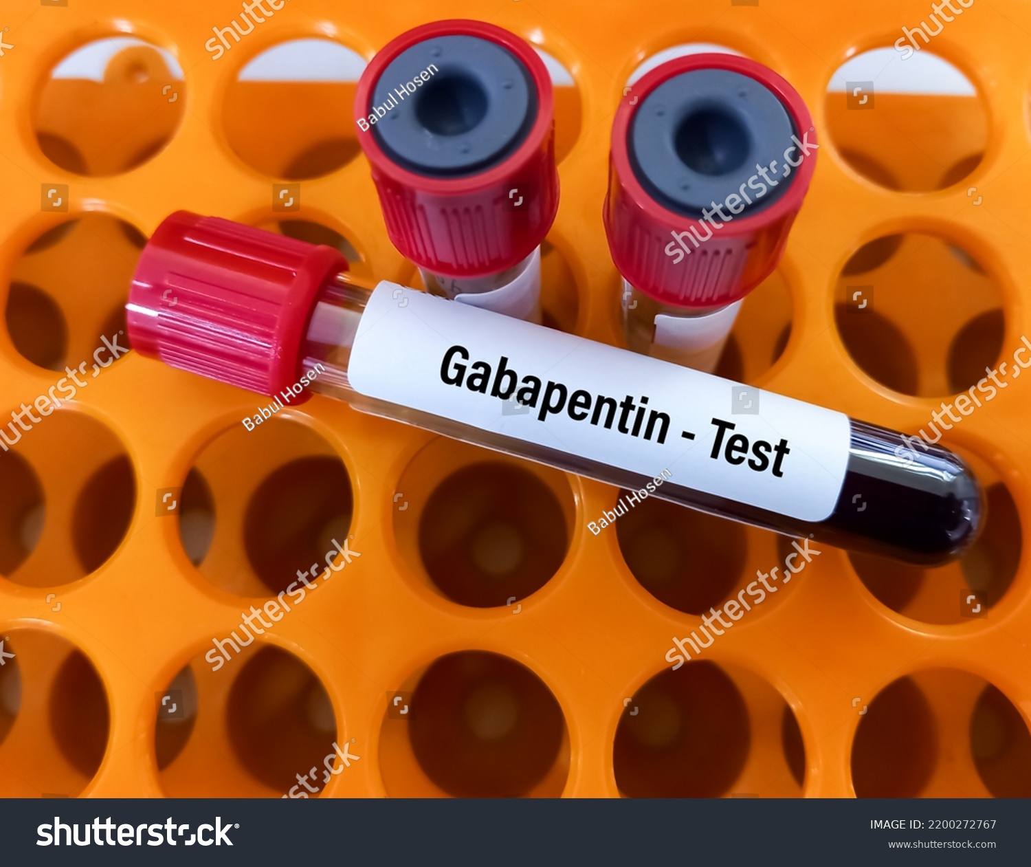 gabapentin for cats blood test