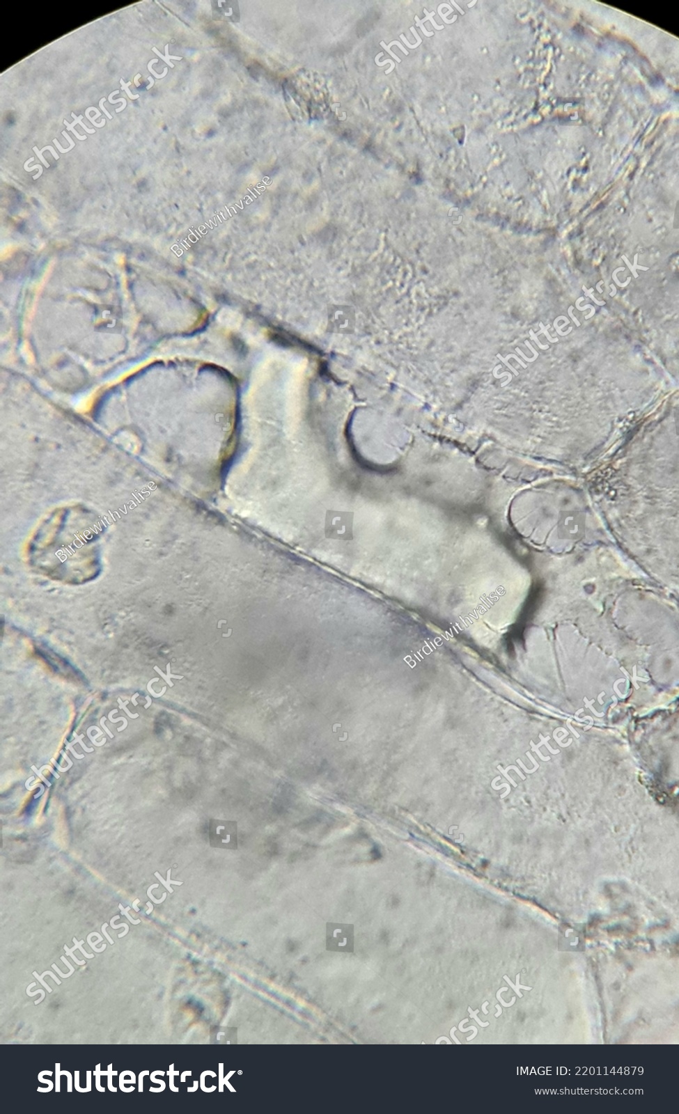 plasmolysis onion cells experiment