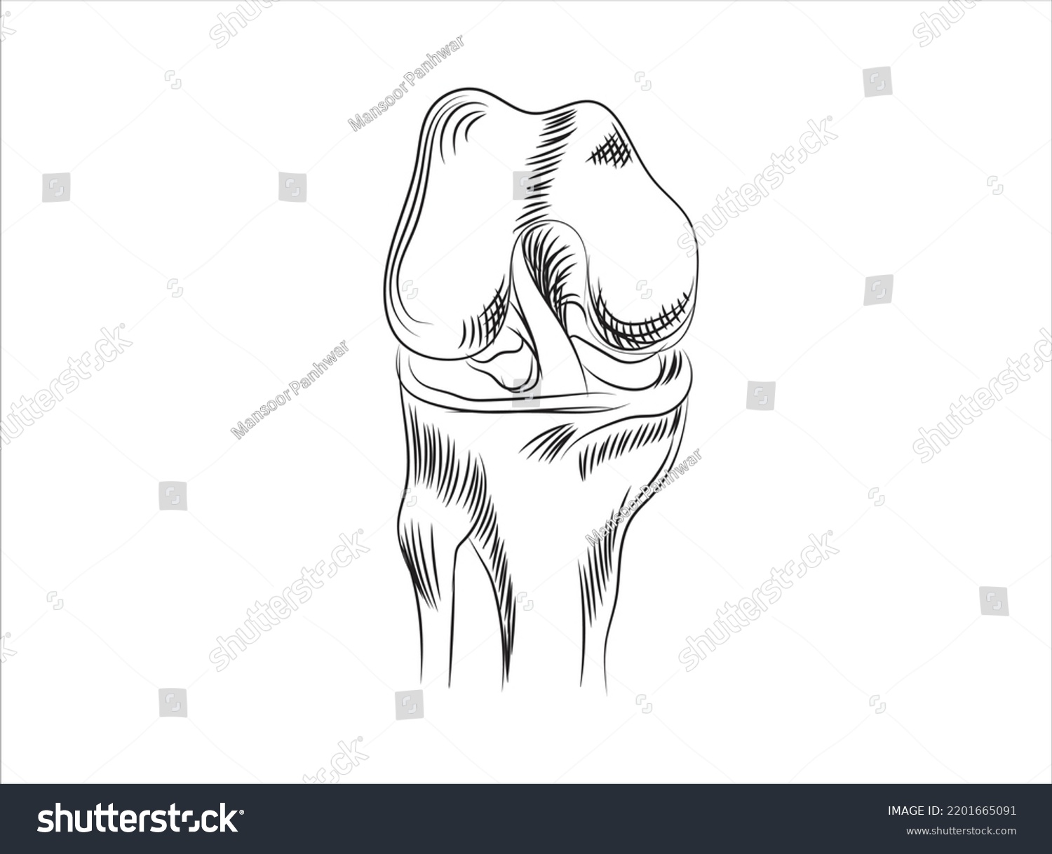 Line Drawing Knee Osteoarthritis Cartilage Knee Stock Vector (Royalty ...