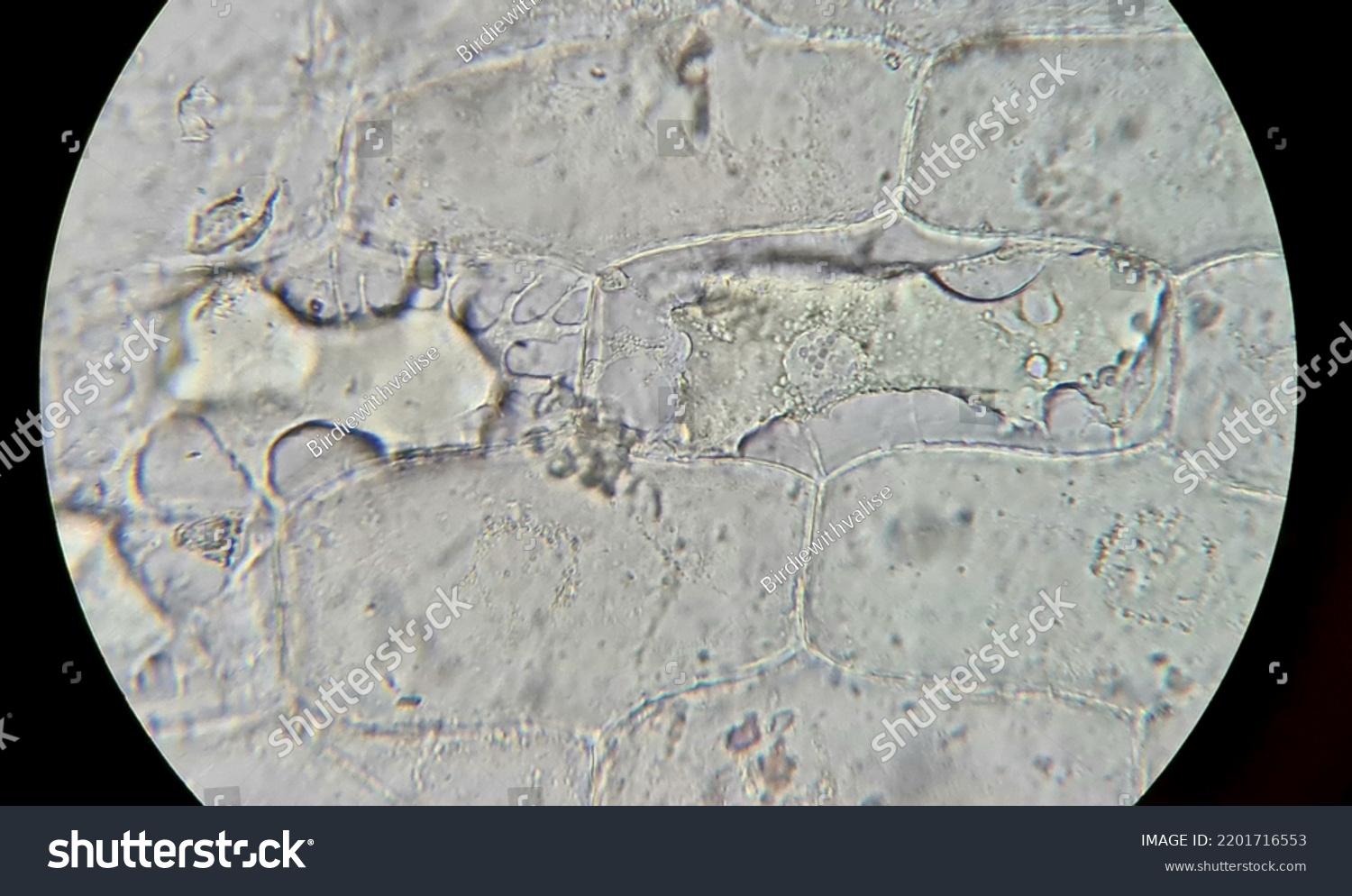 onion epidermal cell experiment