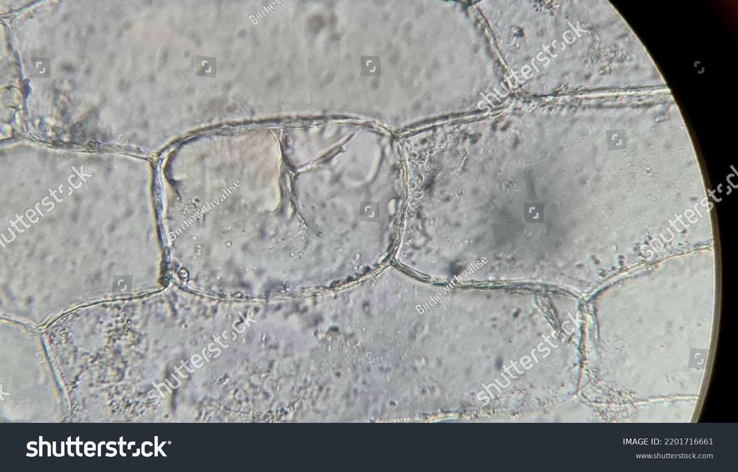 plasmolysis onion cells experiment