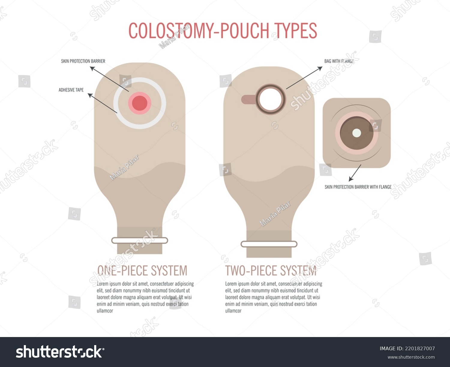 types-colostomy-bags-one-two-pieces-stock-vector-royalty-free