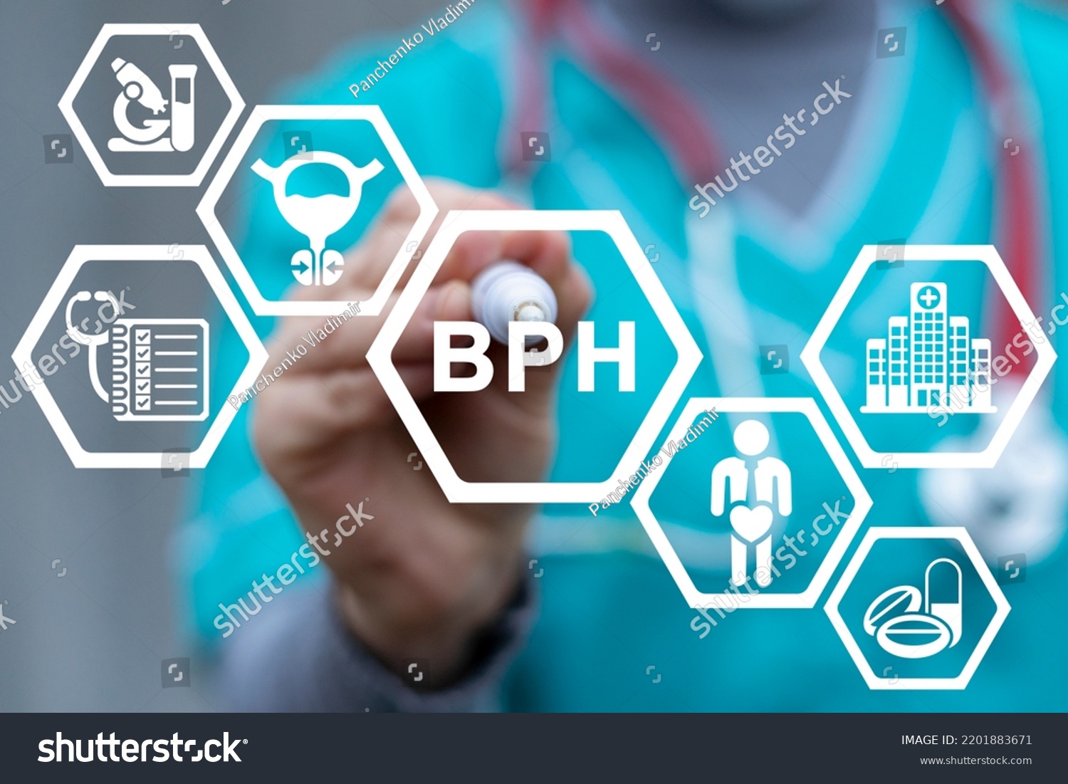 Medical Concept Bph Benign Prostatic Hyperplasia Stock Photo 2201883671 ...