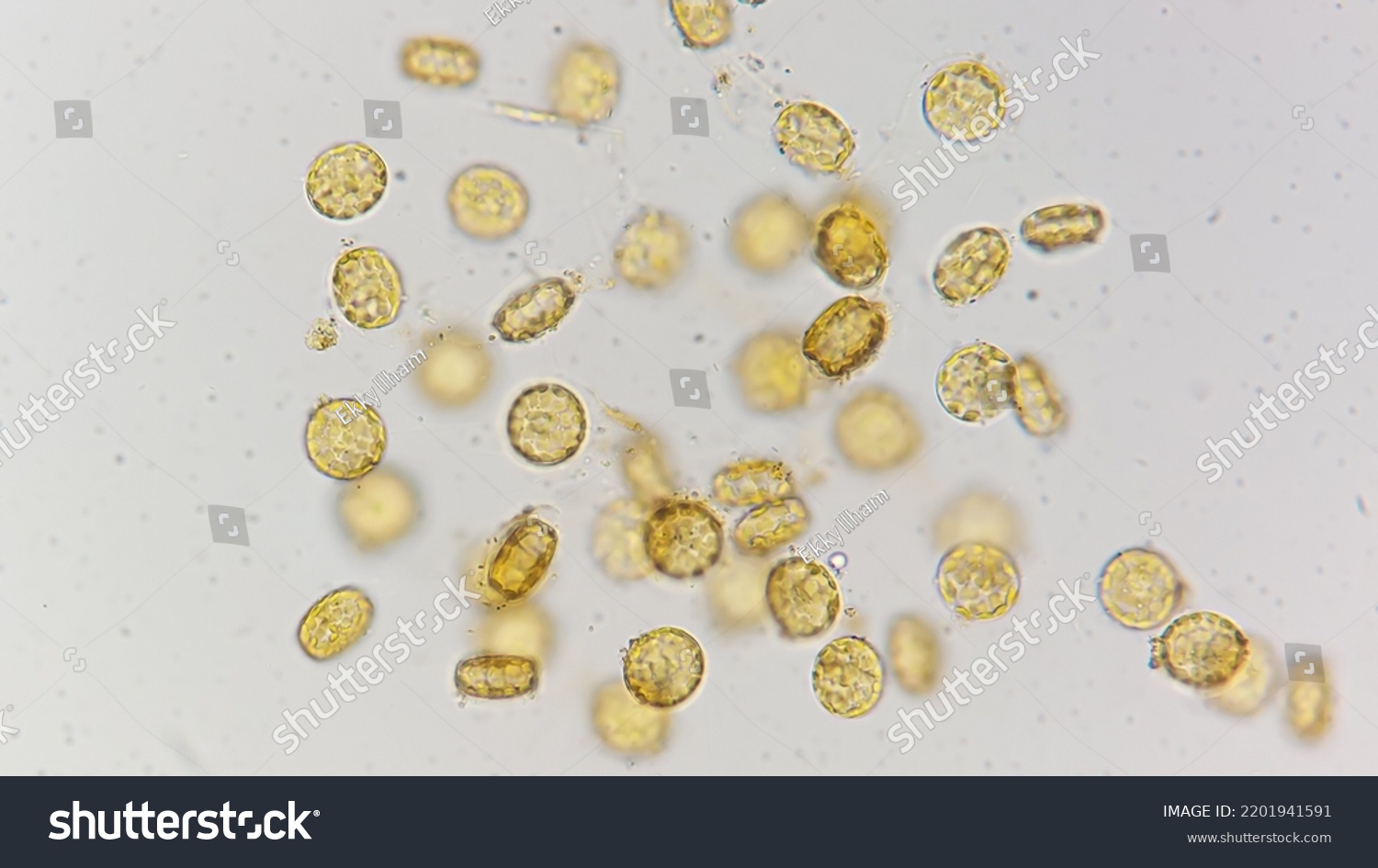 Marine Diatom Called Cyclotella 400x Magnification Stock Photo ...