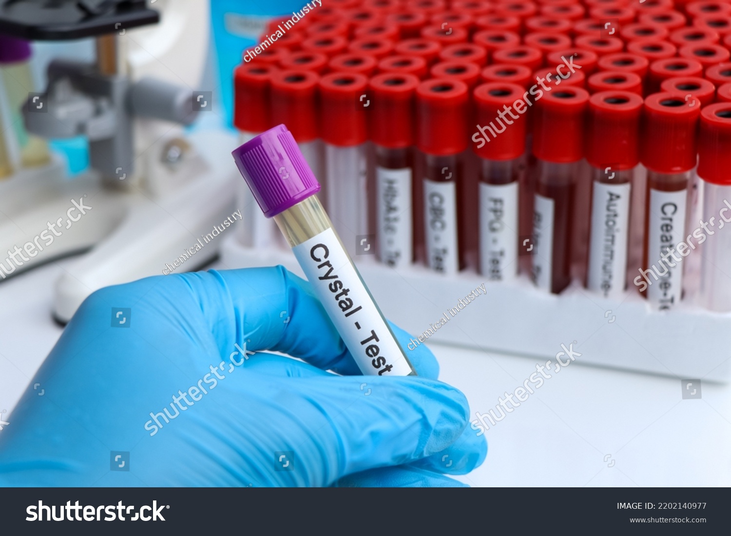 Urine Samples Testing Crystal Laboratory Urine Stock Photo 2202140977 ...