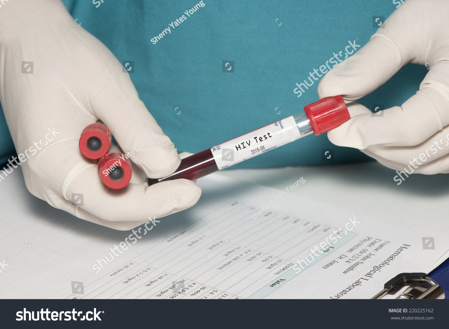 Blood Collection Tube Hiv Test Label Stock Photo 220225162 | Shutterstock