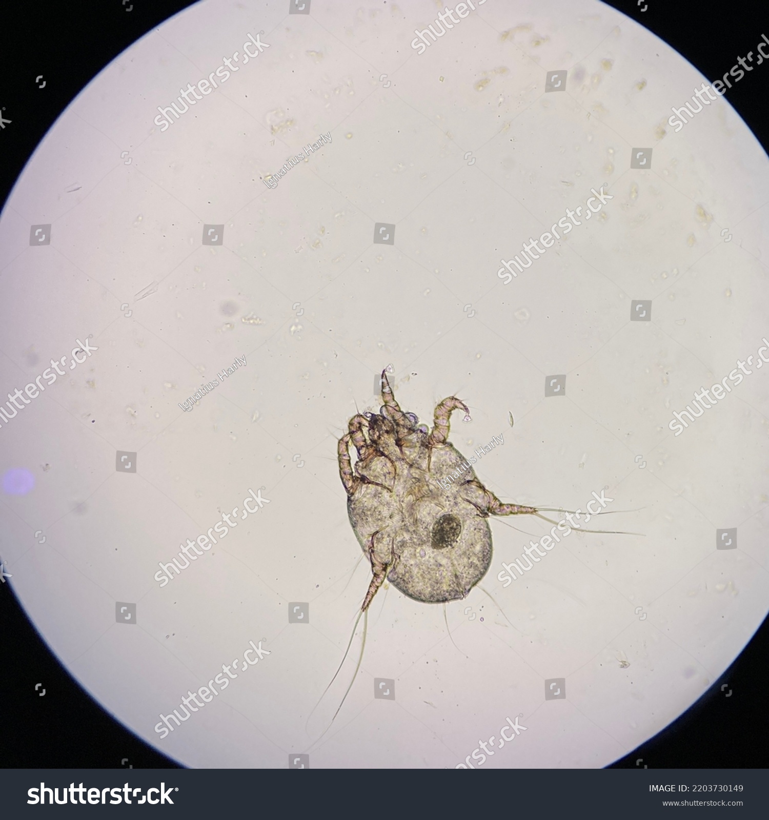 Otodectes Cynotis Ear Mites Under Microscope Stock Photo 2203730149