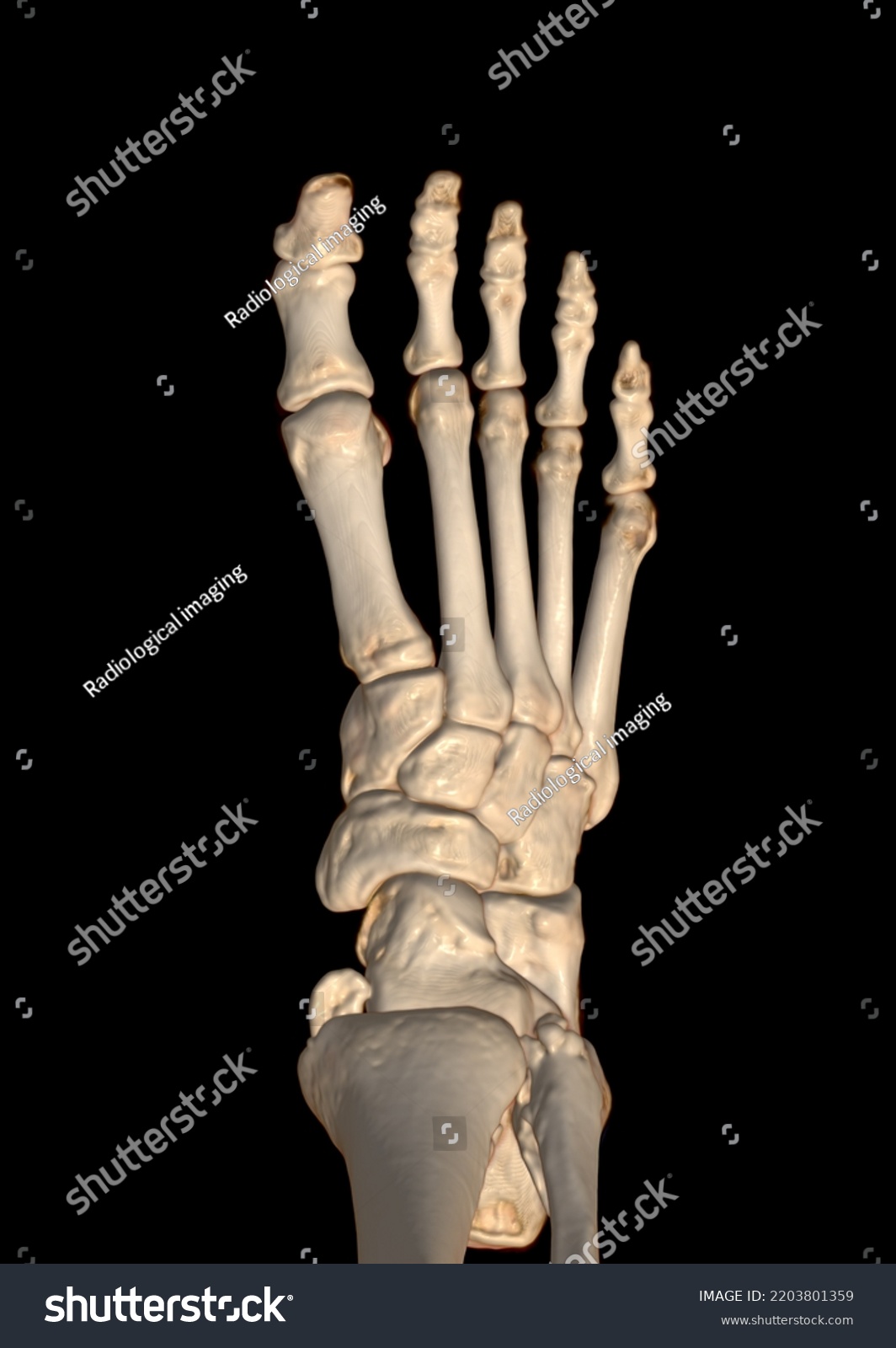 Ct Scan Ankle Foot Computed Tomography Stock Illustration 2203801359 ...