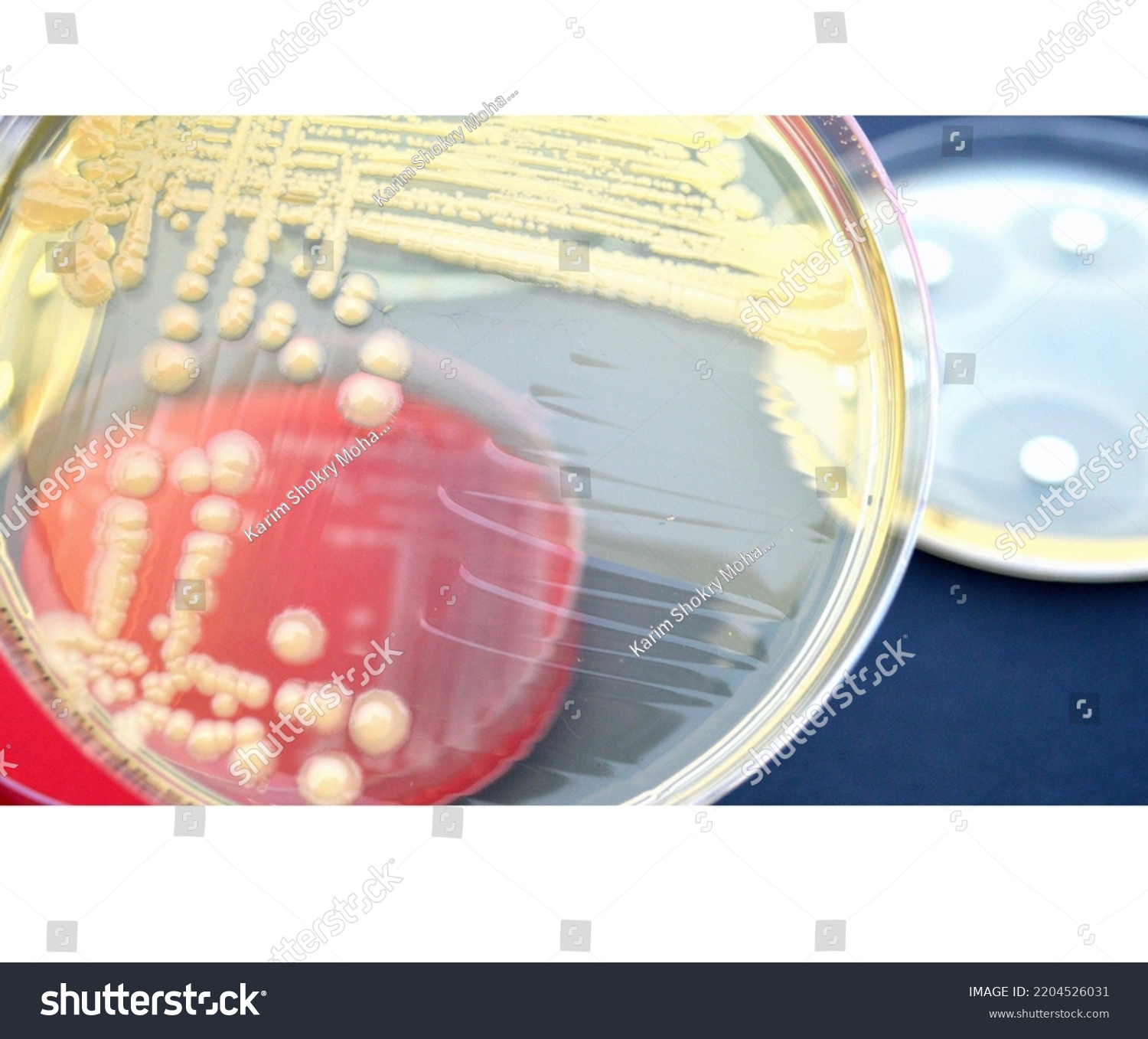 Microbiology Bacteriology Culture Plates Laboratory Stock Photo   Stock Photo Microbiology Bacteriology Culture Plates Laboratory 2204526031 