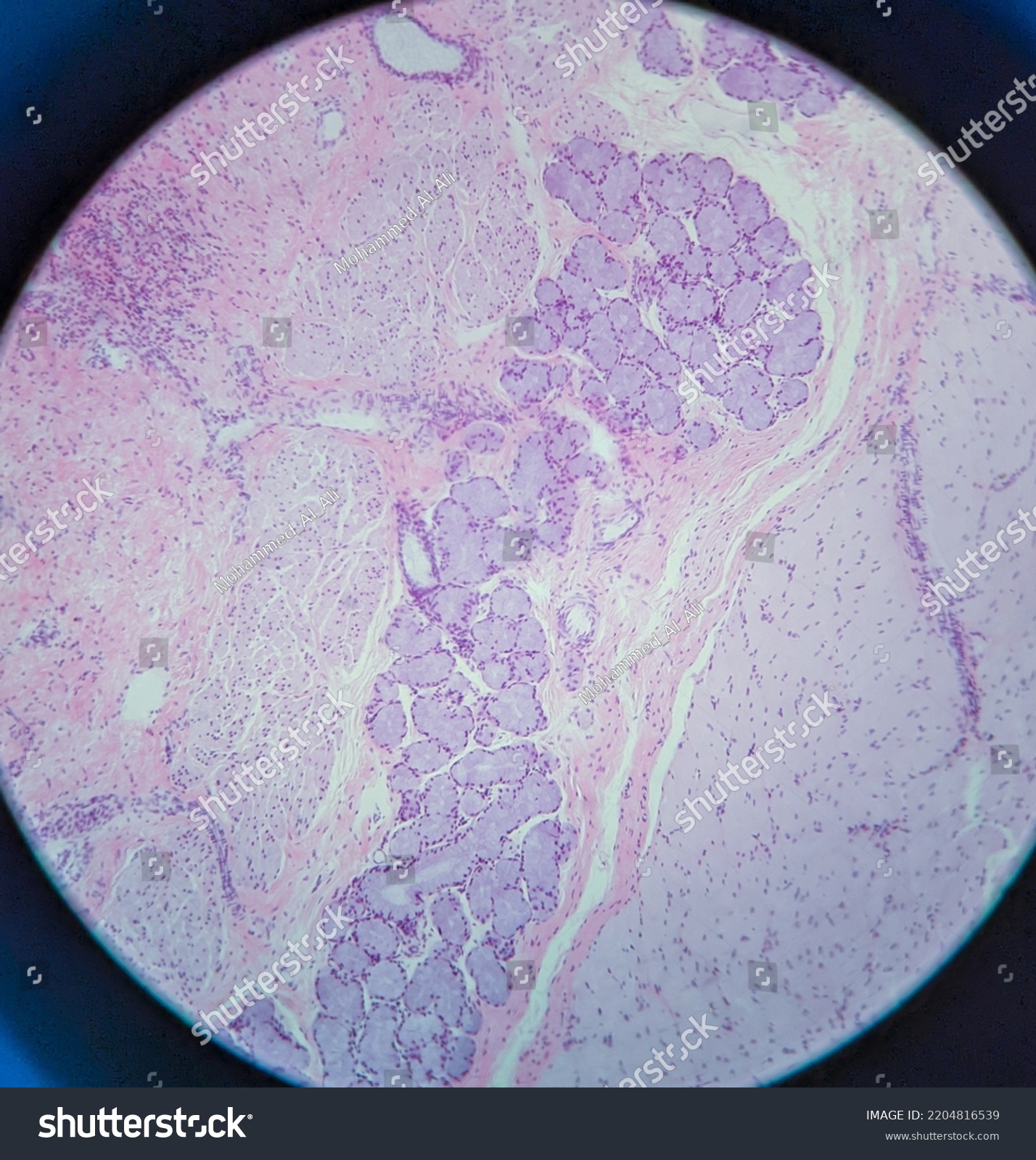 Photo Esophagus Tissue Under Microscope Stock Photo 2204816539