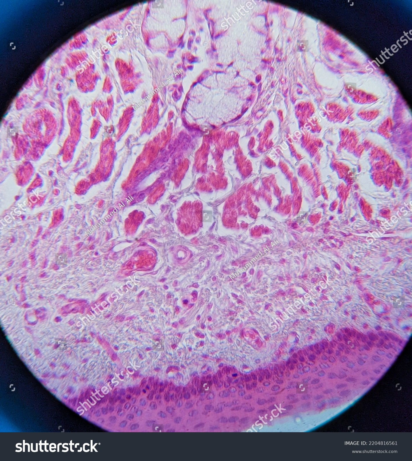 Photo Esophagus Tissue Underr Microscope Stock Photo 2204816561