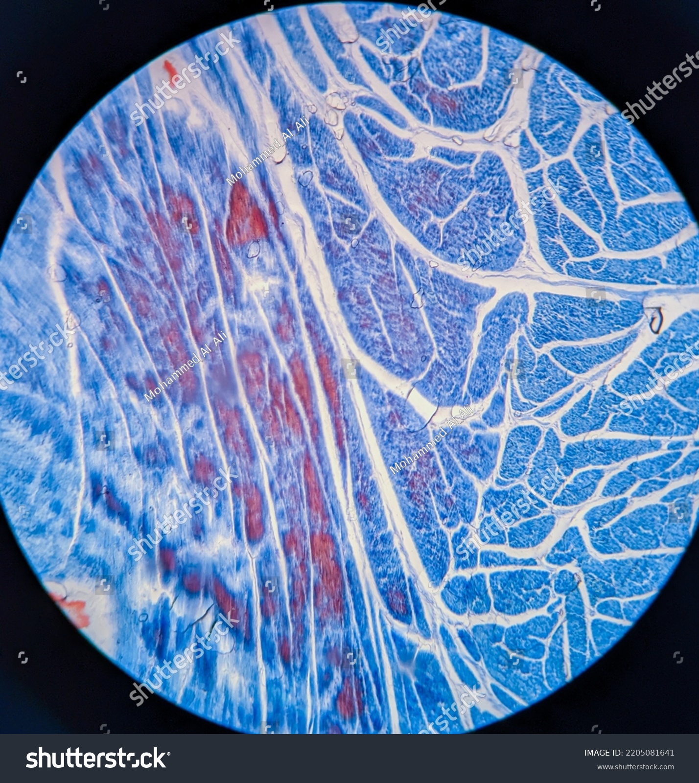 photo-smooth-muscle-tissue-underr-microscope-stock-photo-2205081641