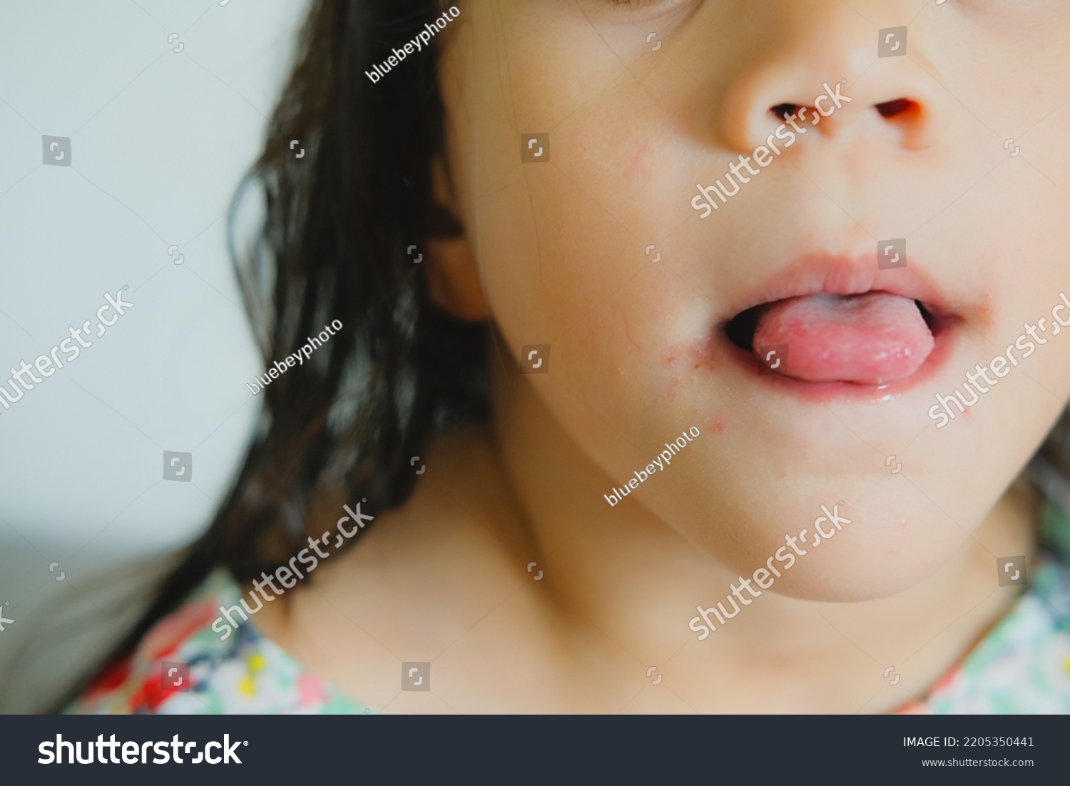 red-spot-on-mouth-hand-foot-stock-photo-2205350441-shutterstock