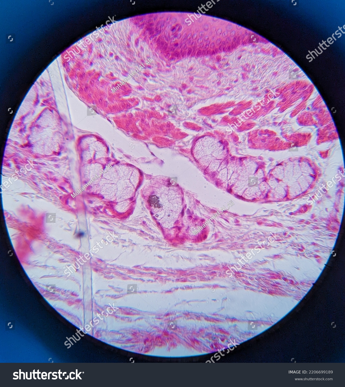 Photo Esophagus Tissue Underr Microscope Stock Photo 2206699189