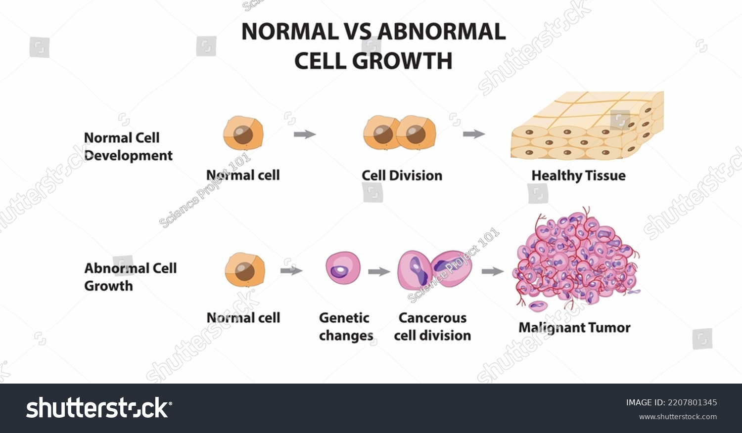 Normal Vs Abnormal Cell Growth Development Stock Vector (Royalty Free ...