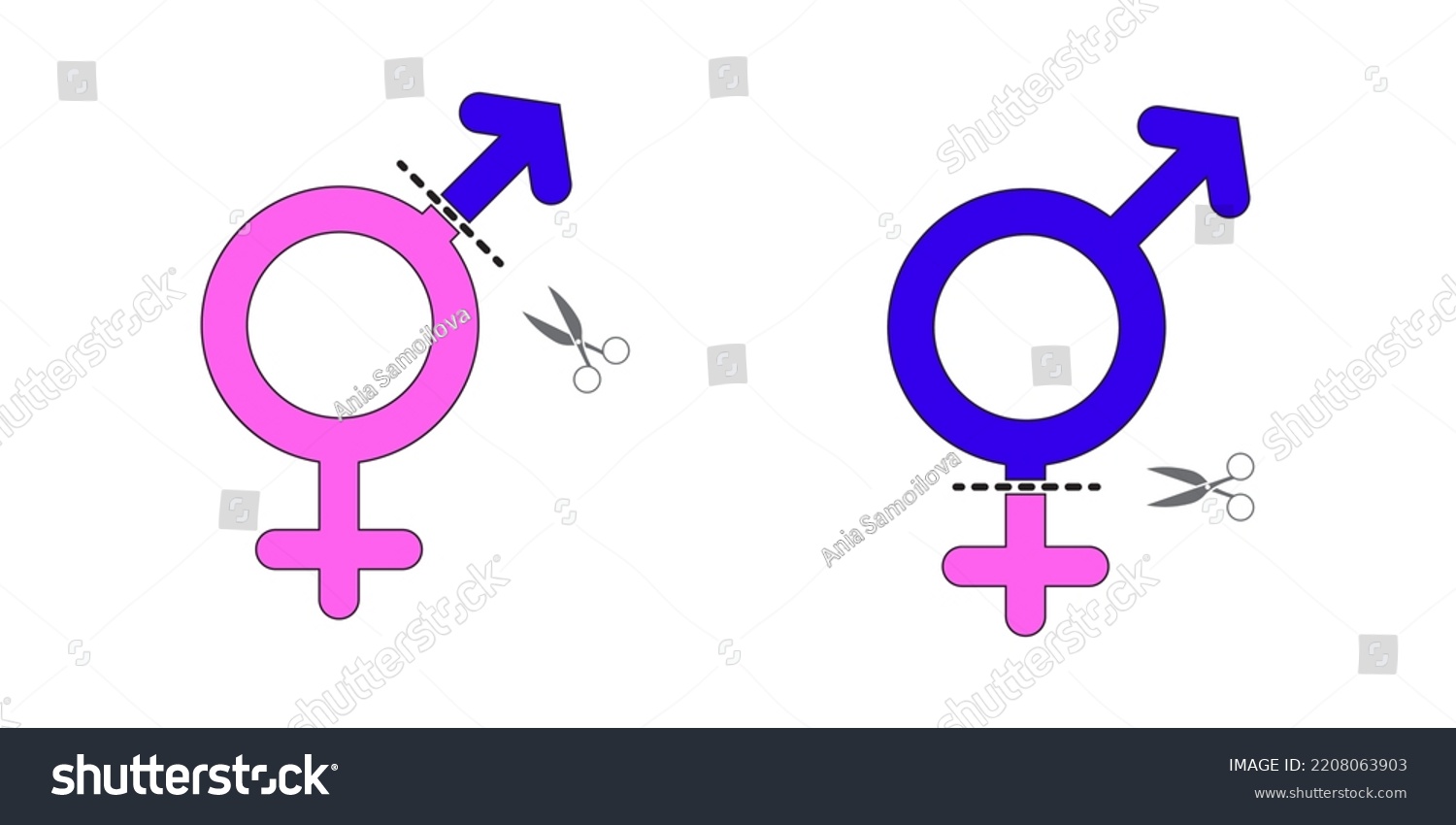 gender reassignment woman to man