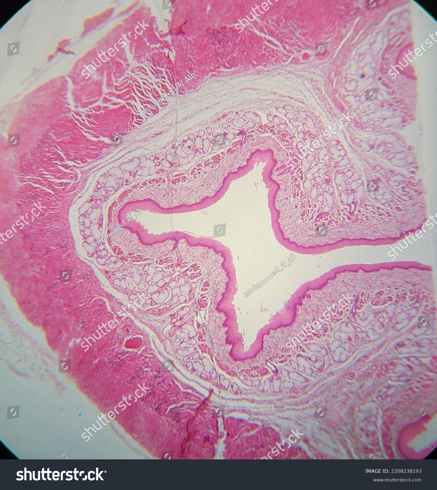 Photo Esophagus Tissue Underr Microscope Stock Photo 2208238193