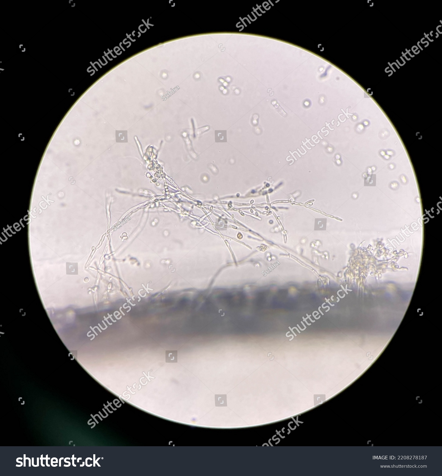 Budding Yeast Cells Pseudohyphae Urine Sample Stock Photo 2208278187 ...