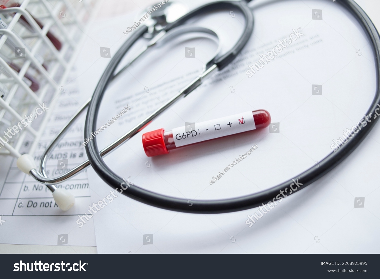 Laboratory Blood Sample Positive G6pd Glucose6phosphate Stock Photo ...