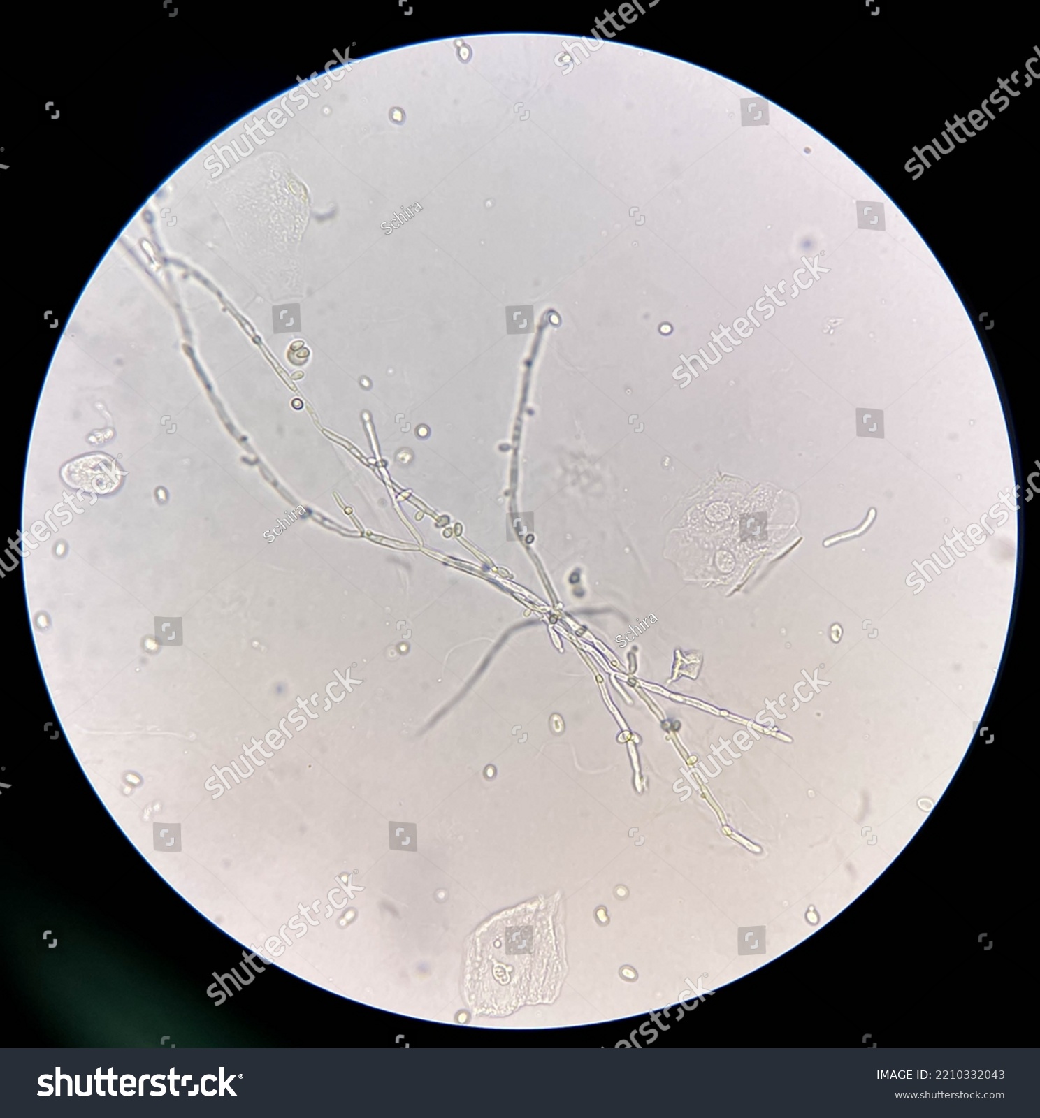 Budding Yeast Cells Pseudohyphae Urine Sample Stock Photo 2210332043 ...