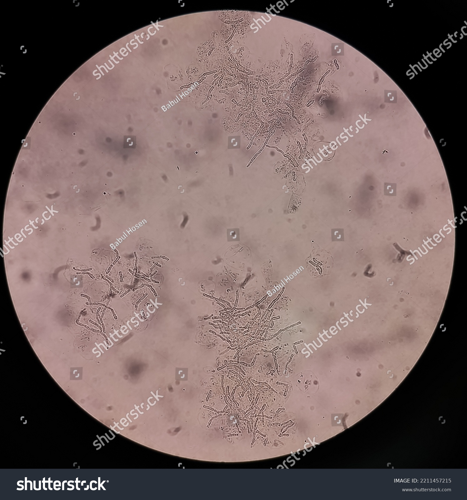 microscopic-fungi-malassezia-furfur-showing-yeast-stock-photo