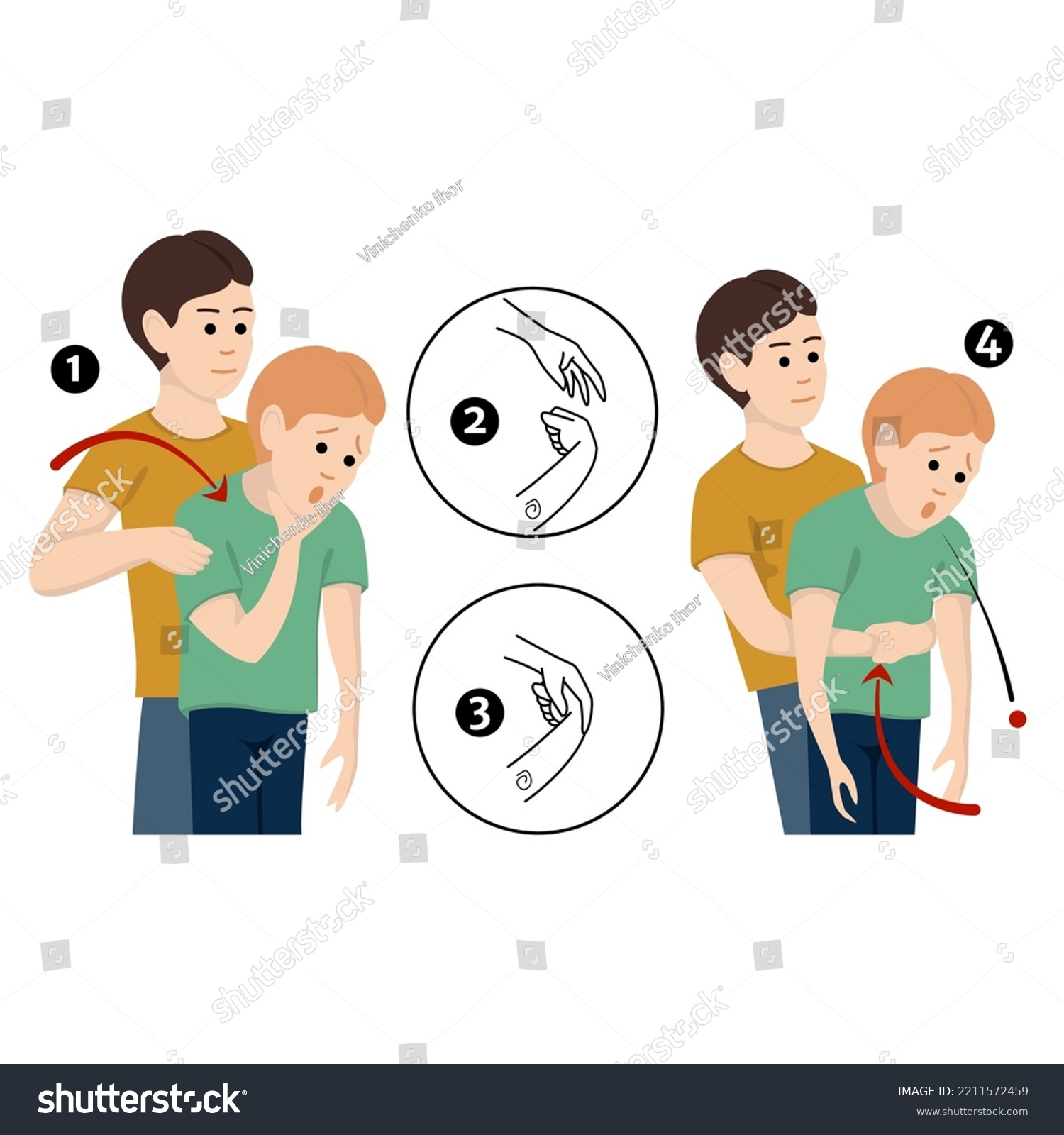 Heimlichs Maneuver First Aid Procedure Choking Stock Vector (Royalty ...