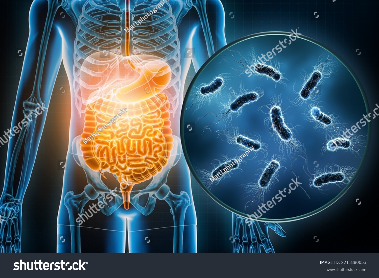 Bacterial Infection Gastrointestinal Tract 3d Rendering Stock ...