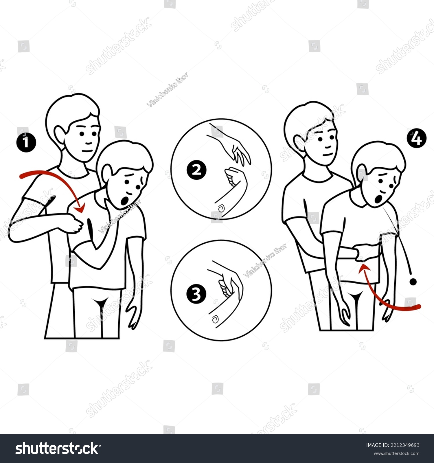 Heimlichs Maneuver First Aid Procedure Choking Stock Vector (Royalty