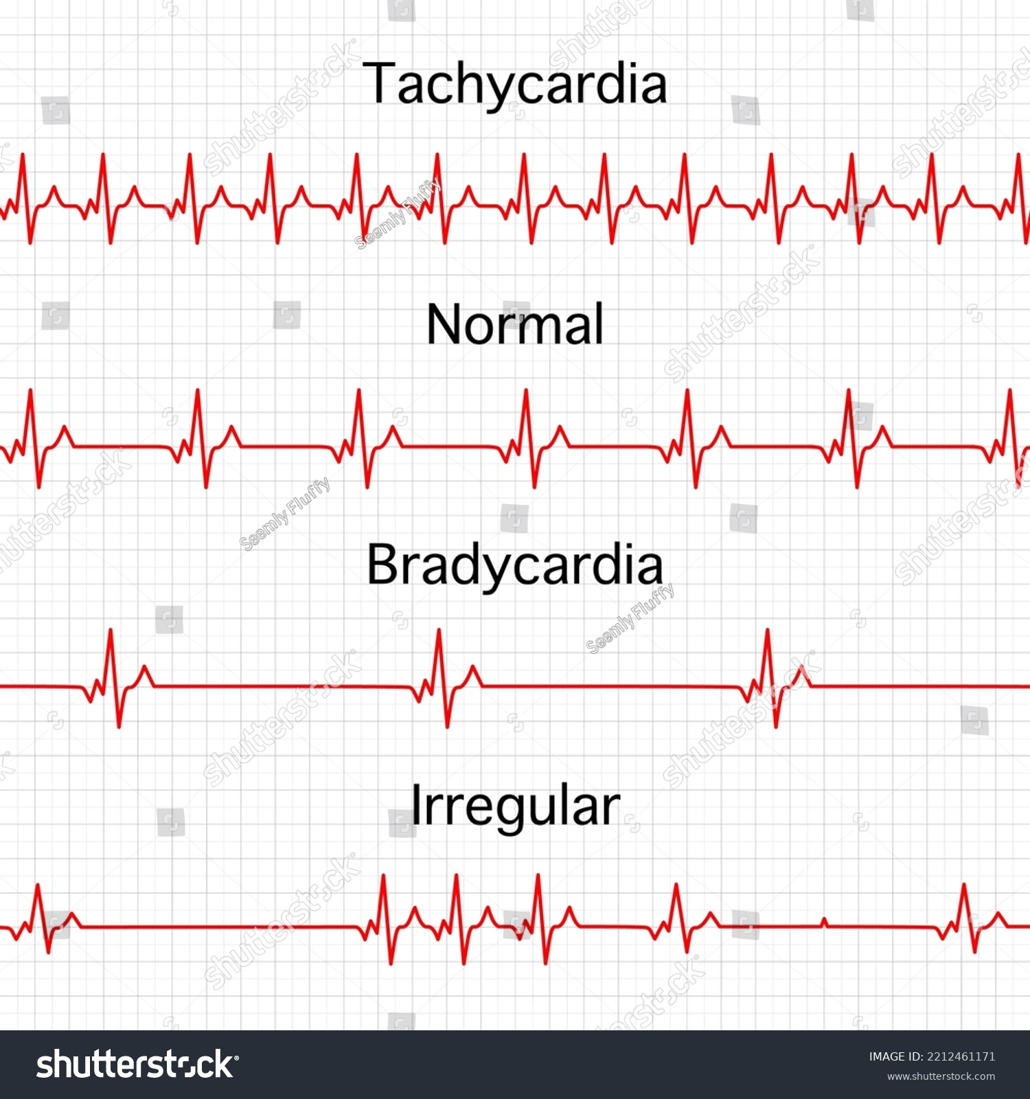 Heart Rate Graphics Vector Illustration Electrocardiogram Stock Vector