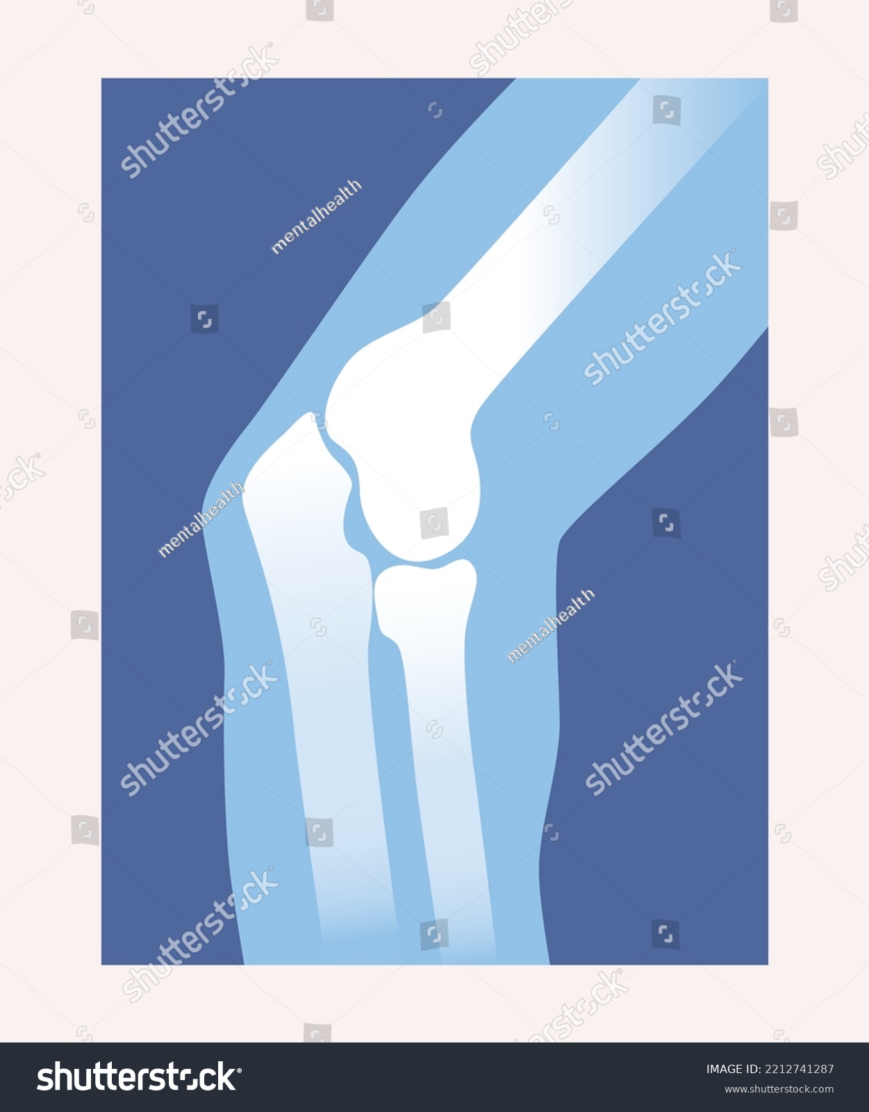 Xray Scan Concept Medical Anatomical Poster Stock Vector (Royalty Free ...