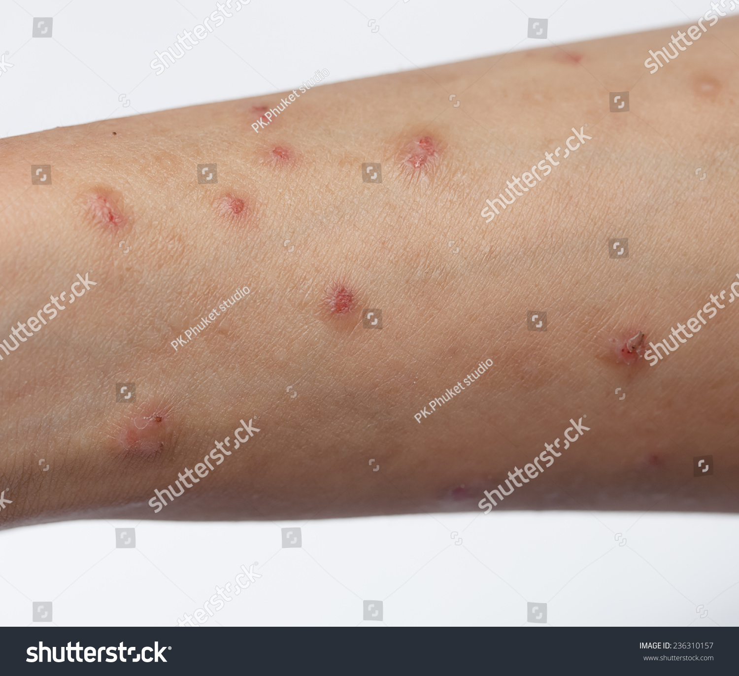 skin diseases on arms