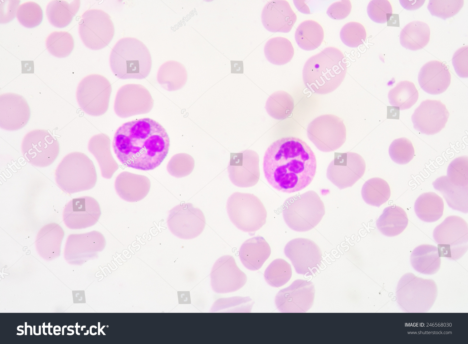 Blood Smear Often Used Followup Test Stock Photo 246568030 | Shutterstock