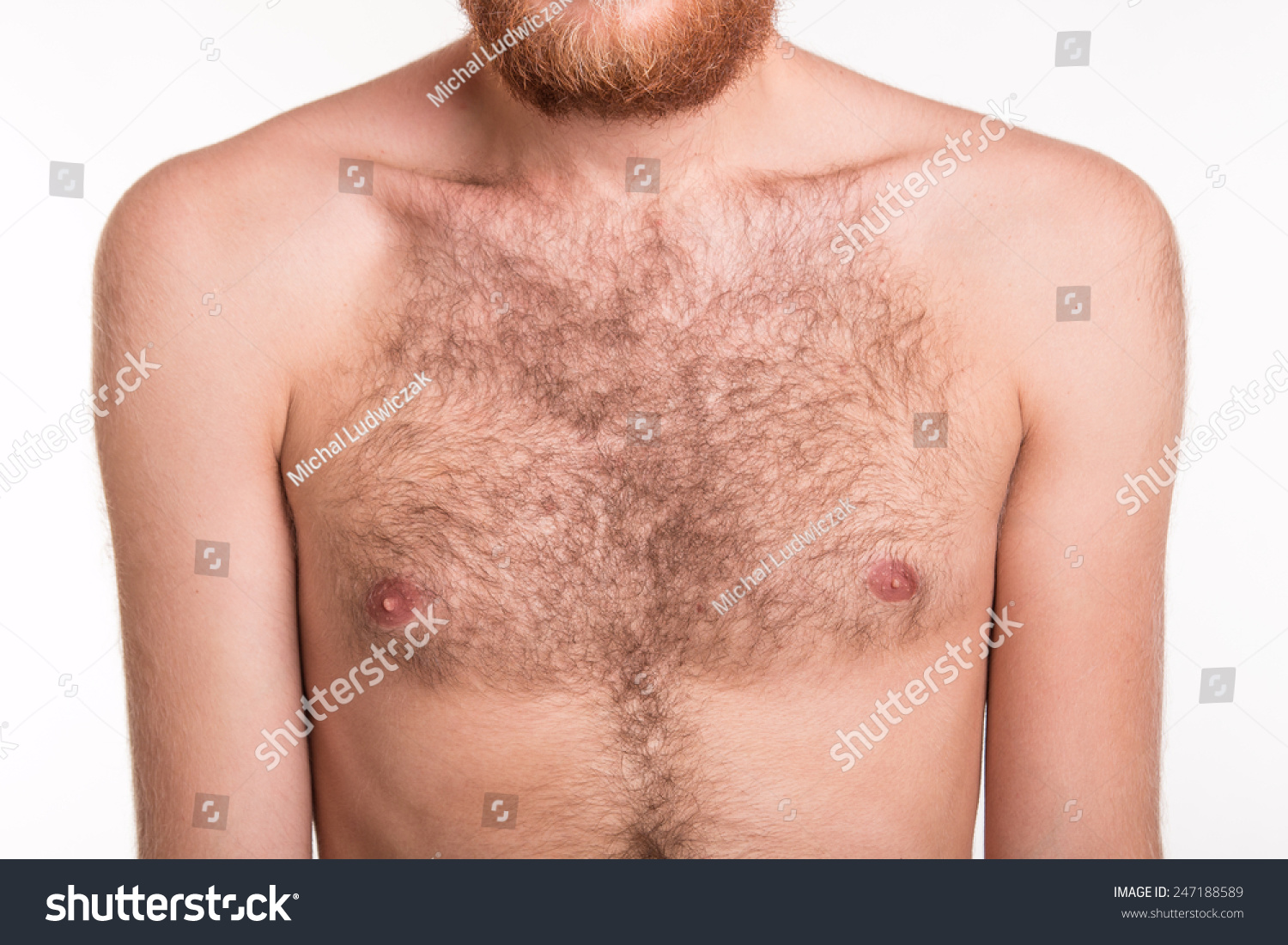 депиляция на груди у мужчин фото 25