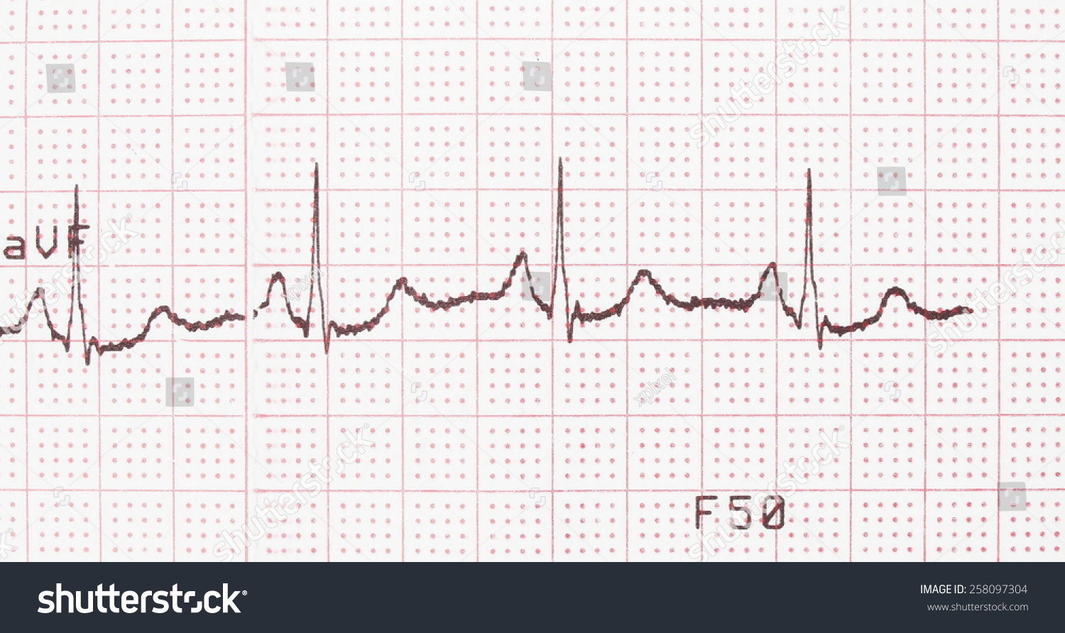 Electrocardiogram Ecg Printout Ekg Background Stock Photo 258097304 ...