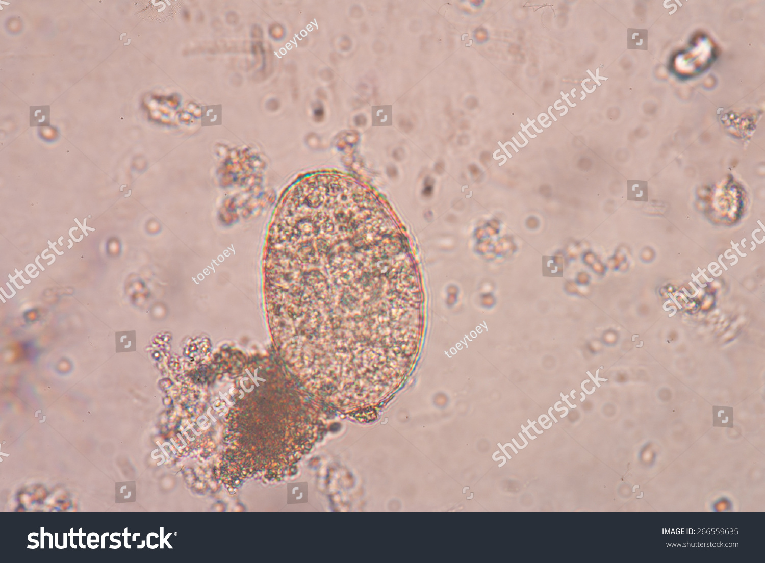 Paragonimus Westermani Major Species Lung Fluke Stock Photo 266559635