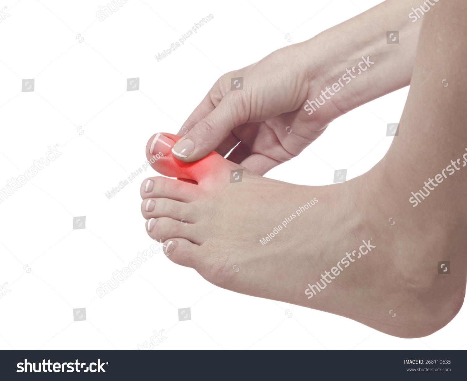 Painful Inflamed Gout On His Foot Stock Photo 268110635 Shutterstock
